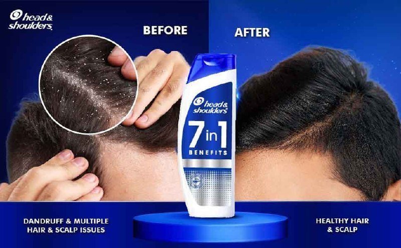 Head Shoulders Shampoo 1 Ltr 498buy Max Qnty Honey