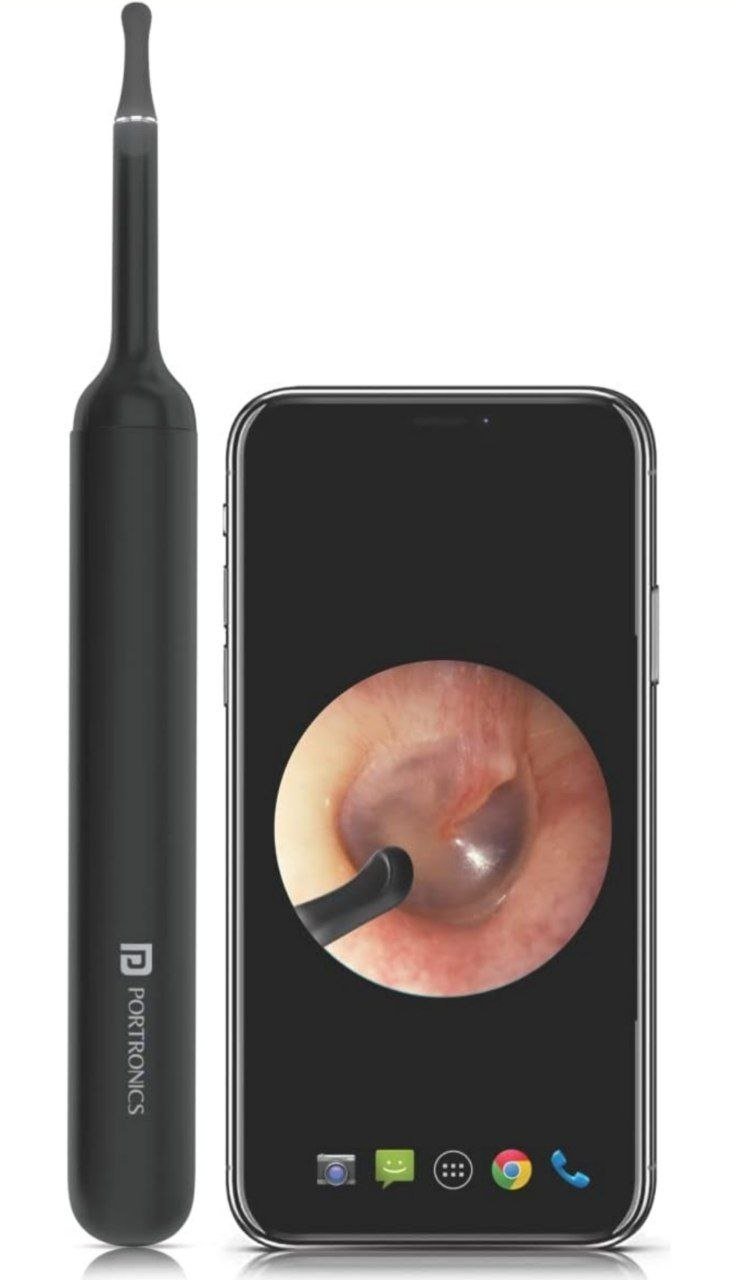 Portronics Xlife Smart Wireless Ear Otoscope Clean